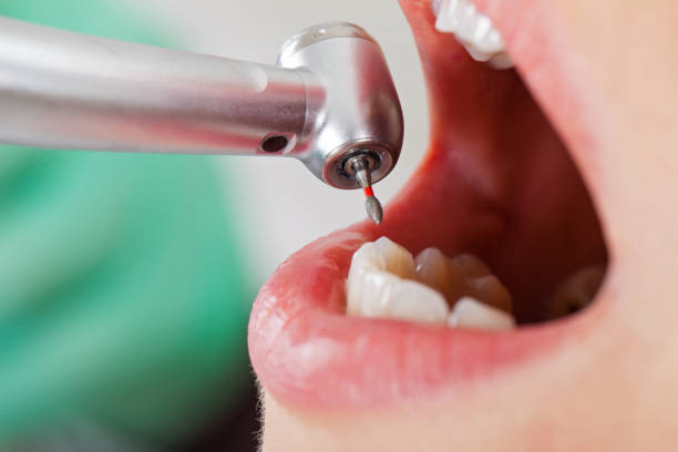 Best Tooth Infection Emergency Dentist  in Mill Creek East, WA